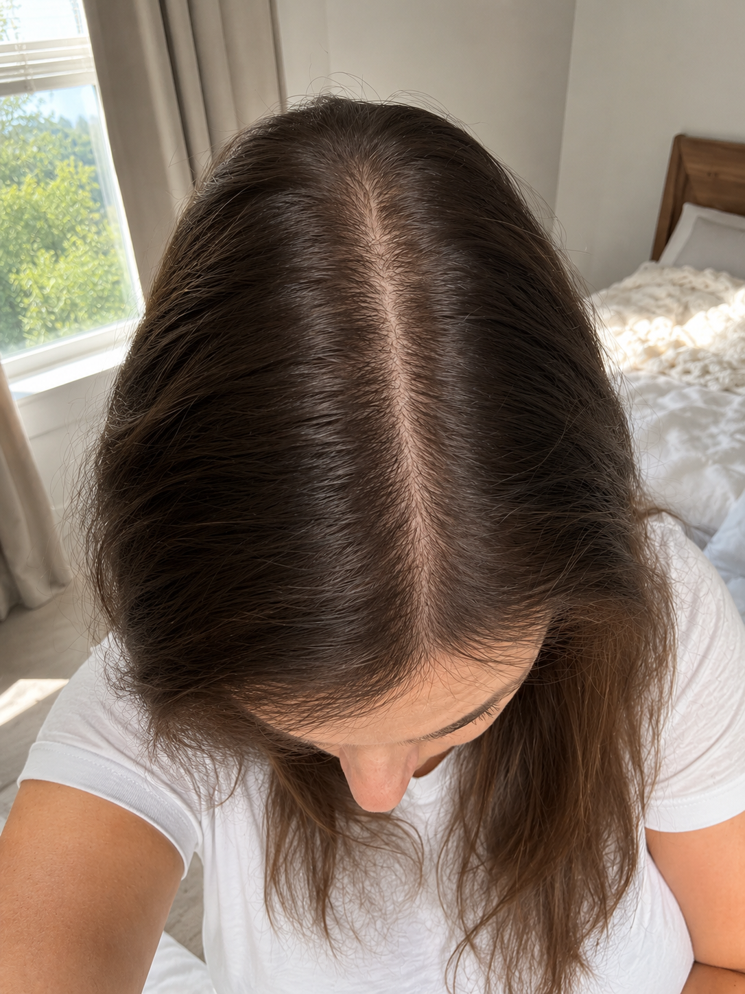 After — crown restored