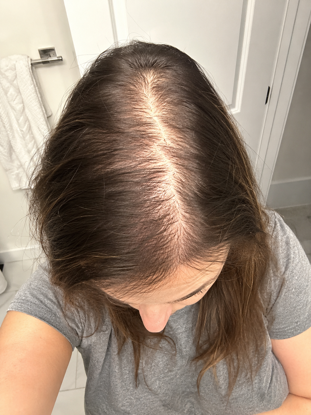 Before — crown thinning