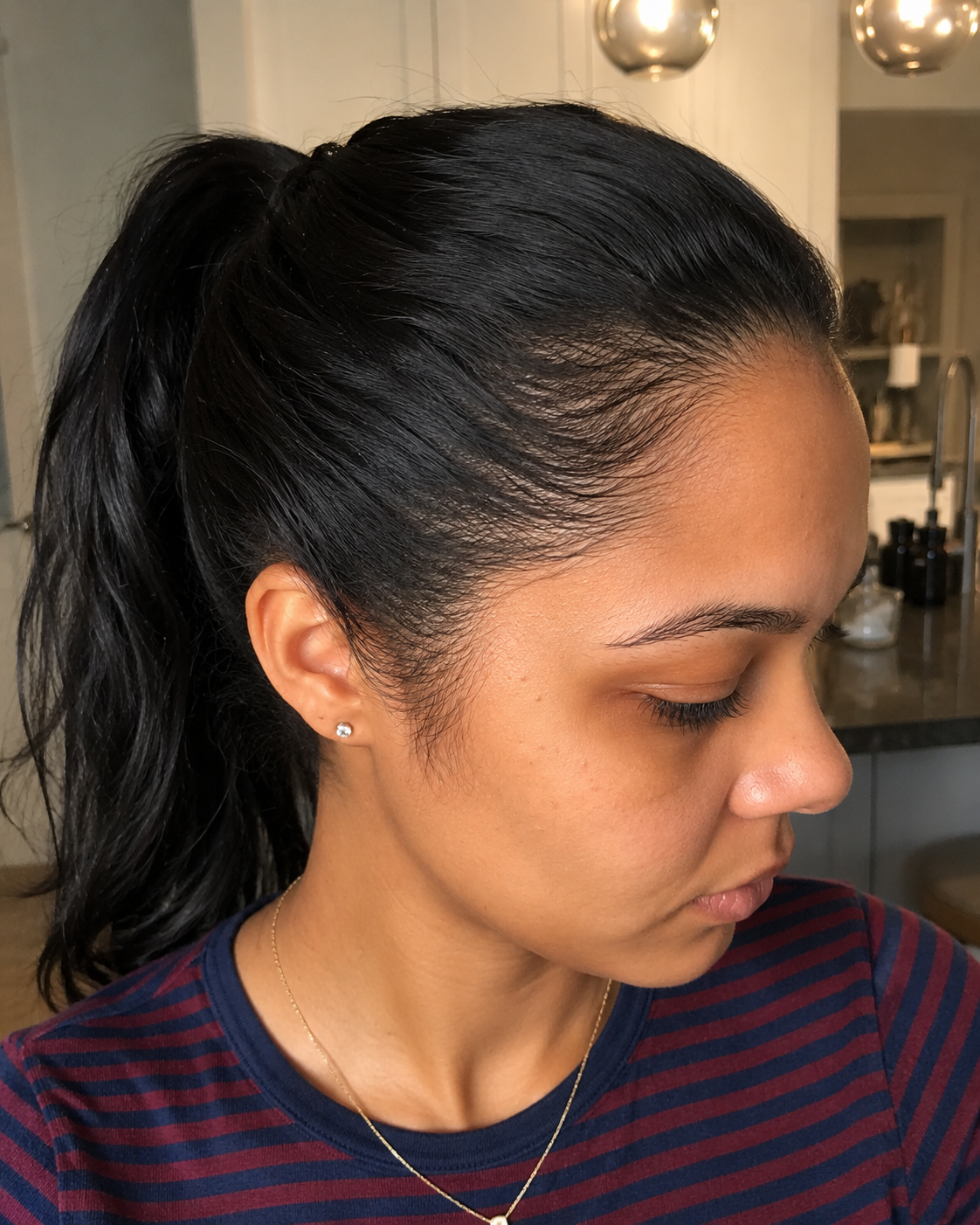 After — temples filled in
