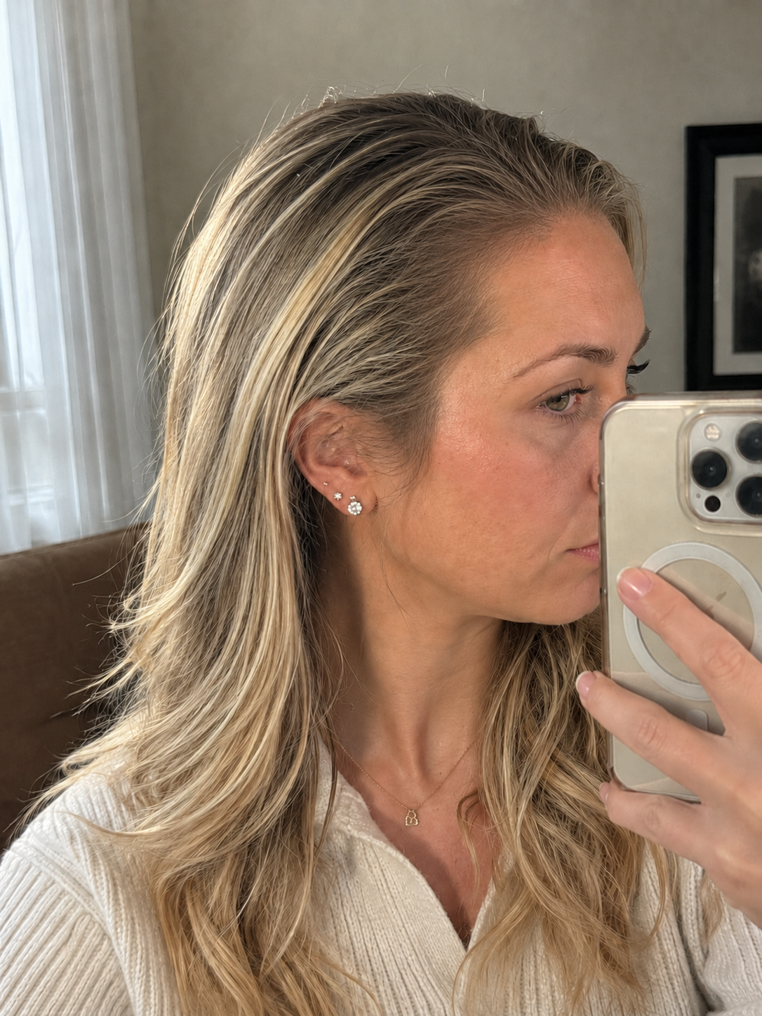 After — hairline full